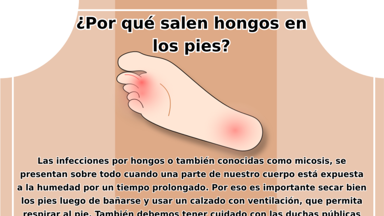 Hongos en los pies